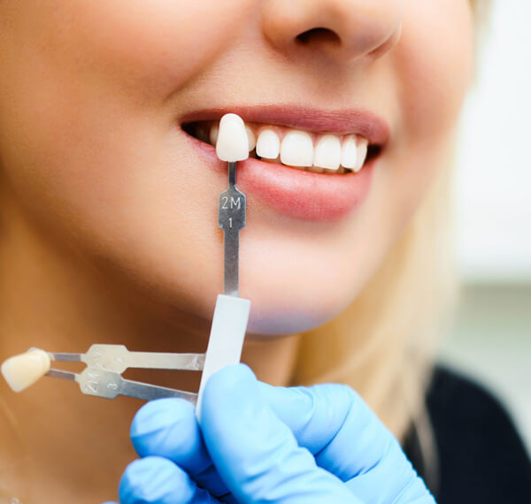 What is the teeth whitening process?
