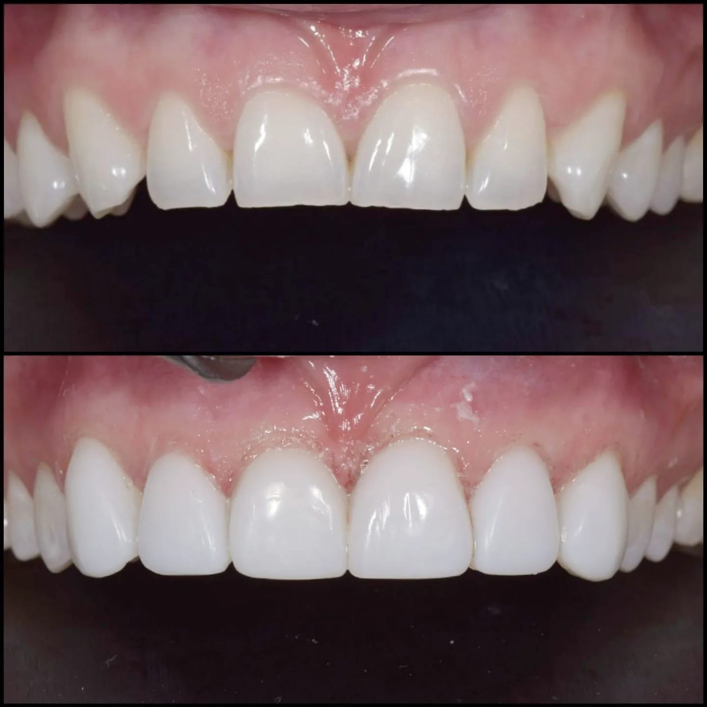 before after 2