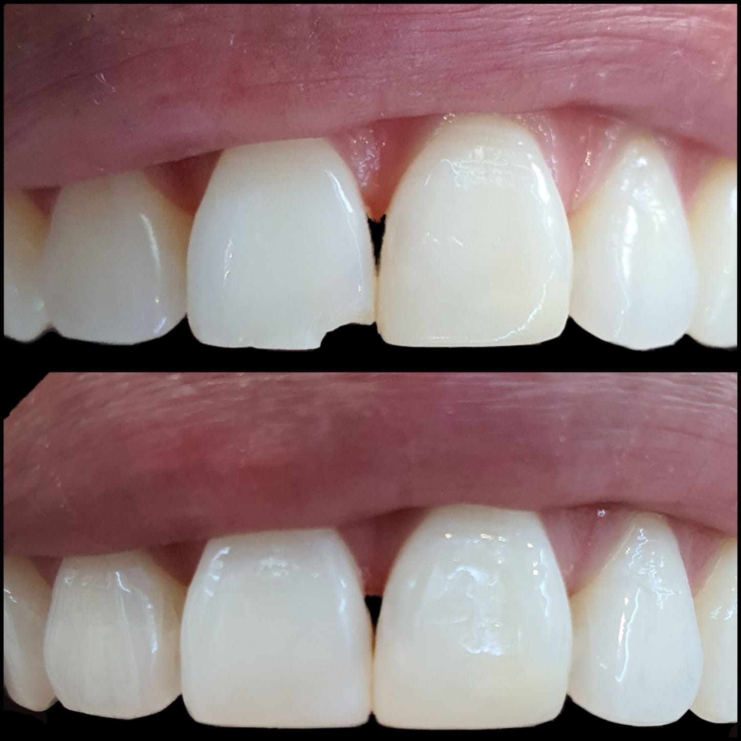 before after 3