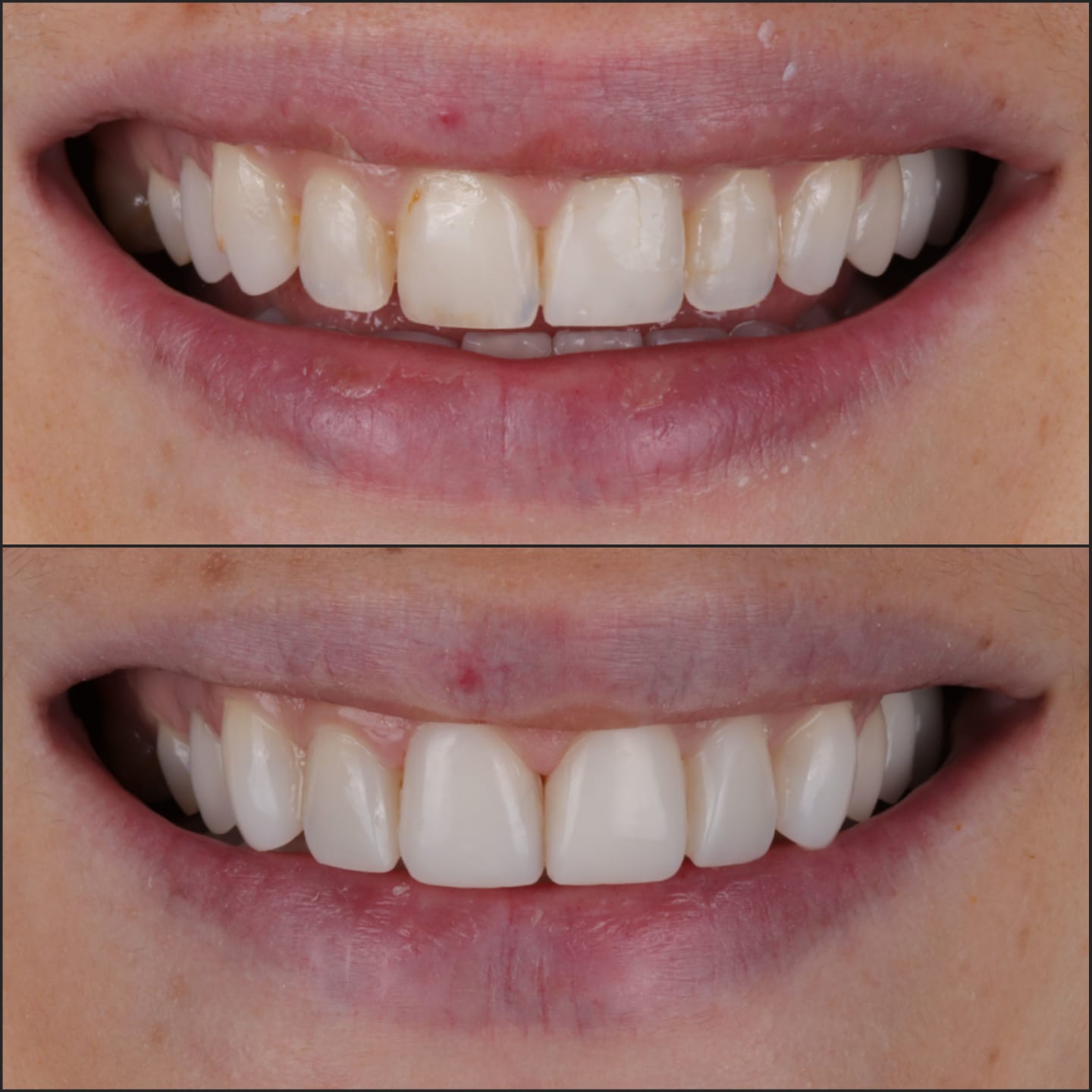 before after 4