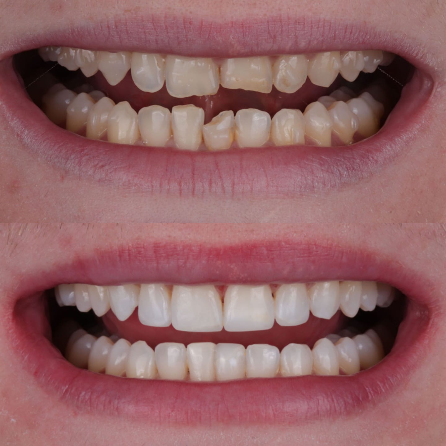 before after 5