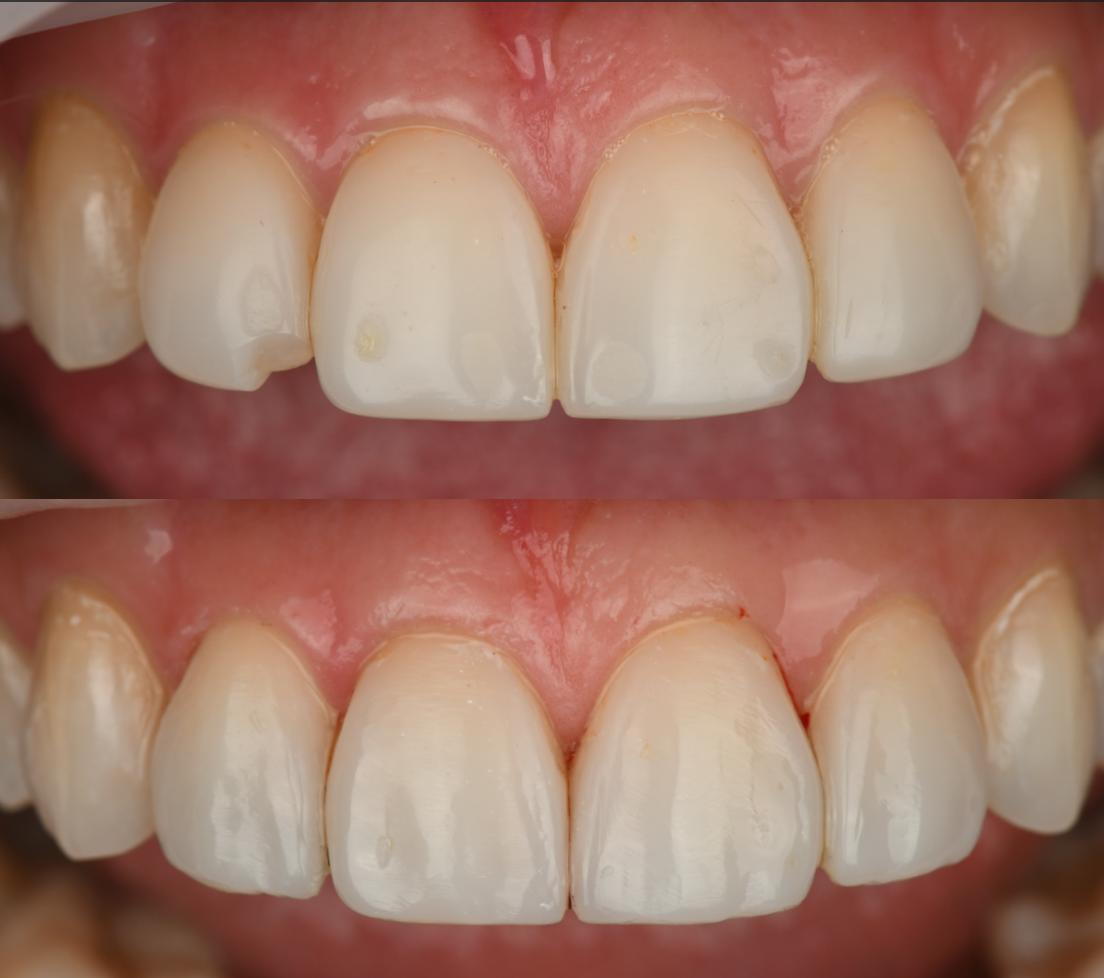 before after 6