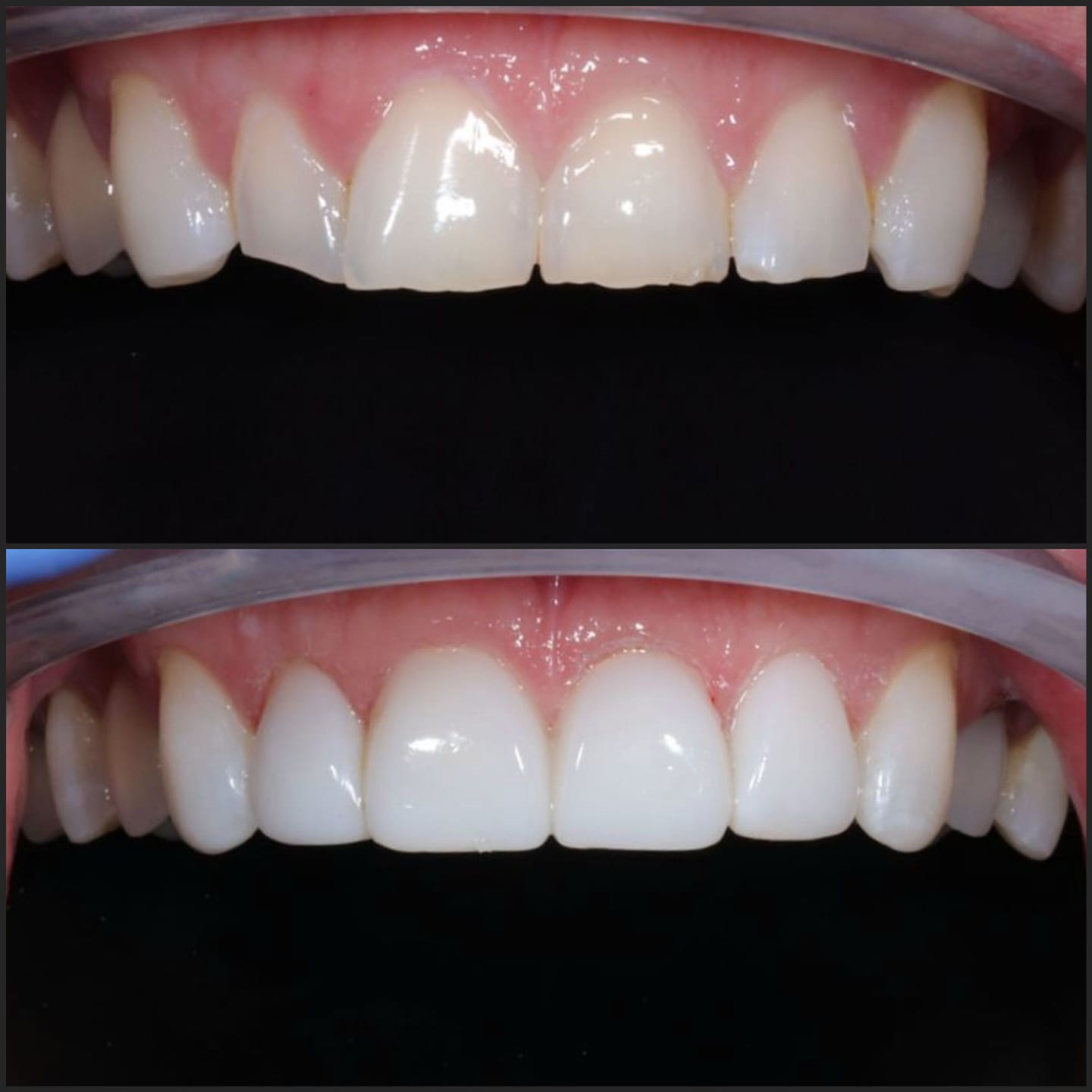 before after 7